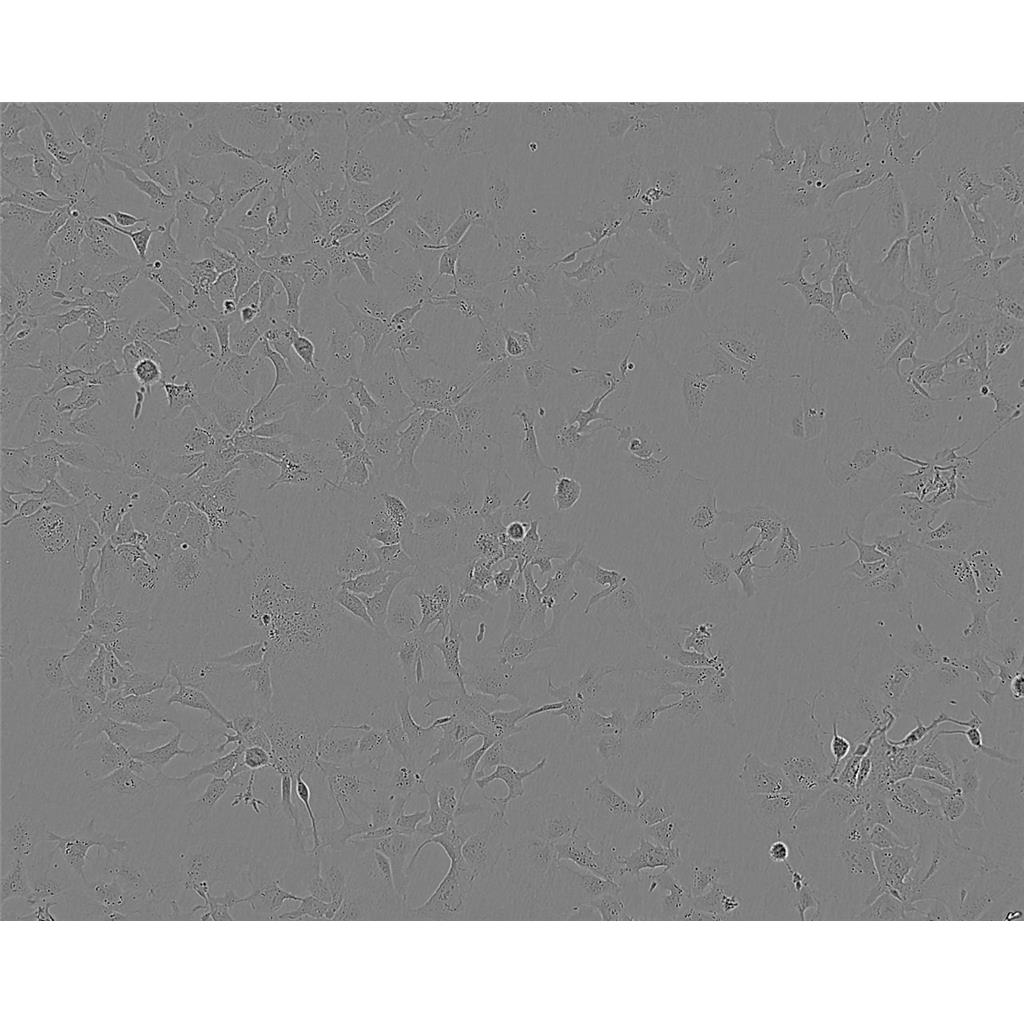 HTh 7 Cells#人甲状腺癌细胞系复苏中心|完全培养基|STR图谱
