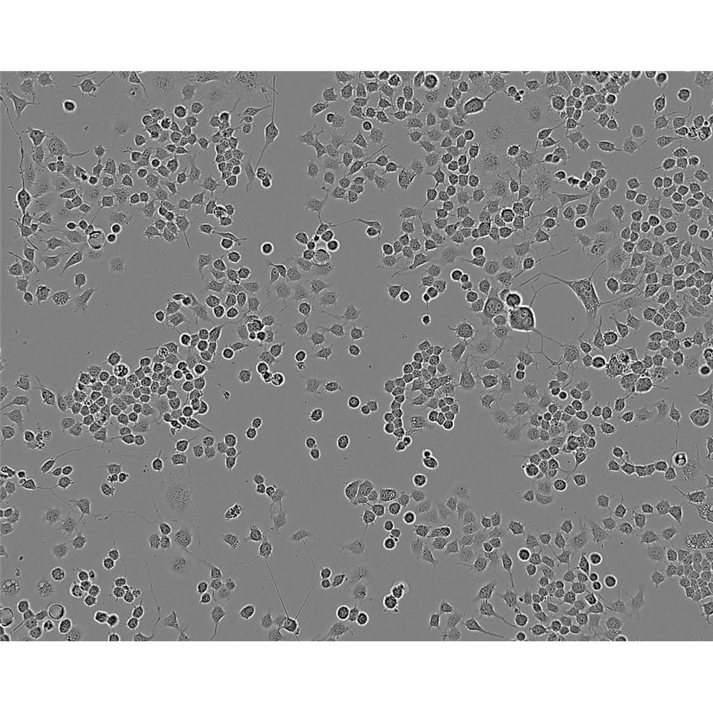 KHM5M Cells#人甲状腺癌细胞系复苏中心|完全培养基|STR图谱