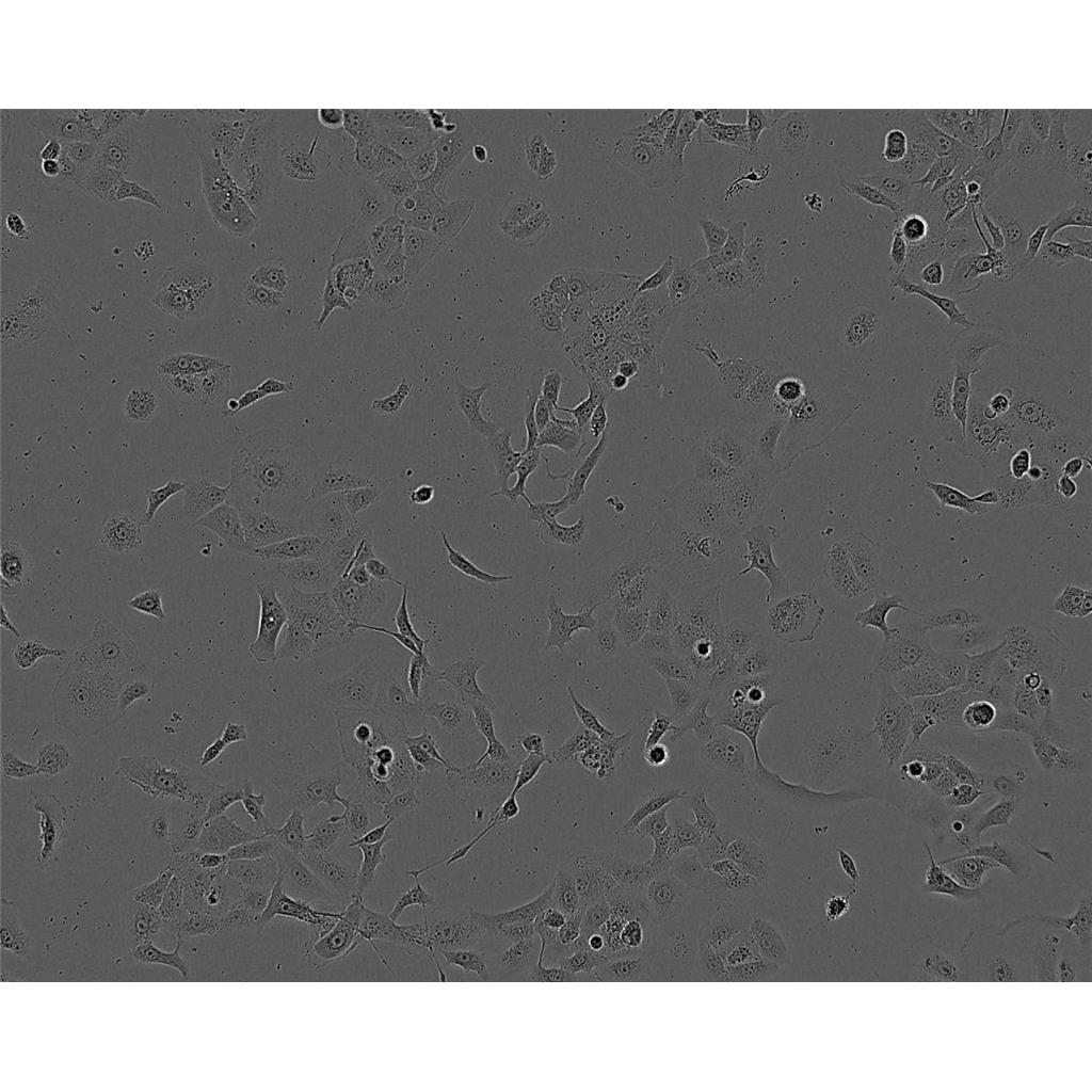 JVM-2人套细胞淋巴瘤细胞库|培养基|带STR图谱