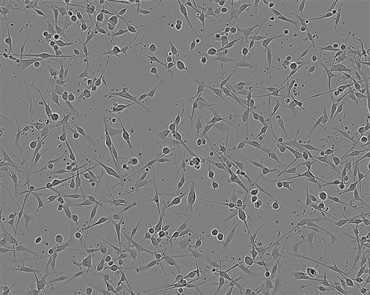 HCC70人乳腺导管癌细胞库|培养基|带STR图谱