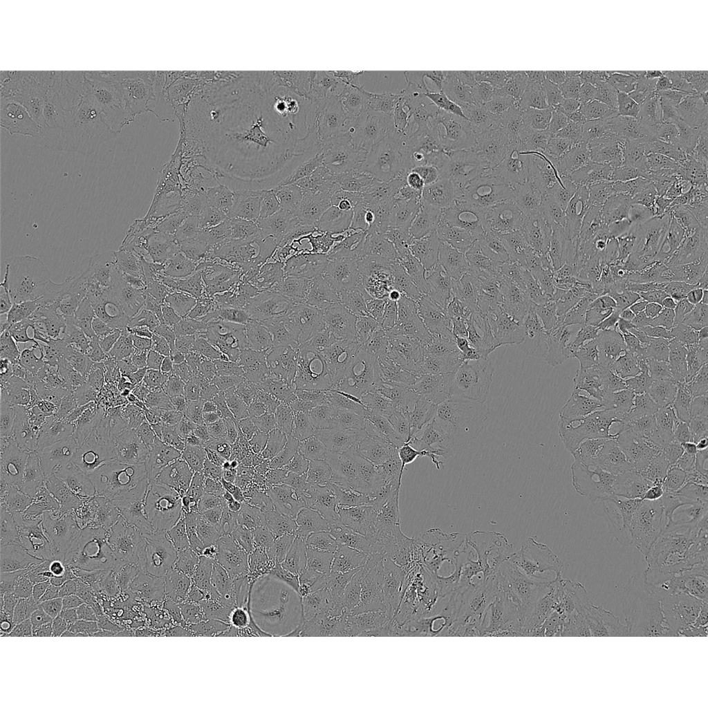 MDA-MB-468人乳腺癌细胞实验室|已有STR图谱