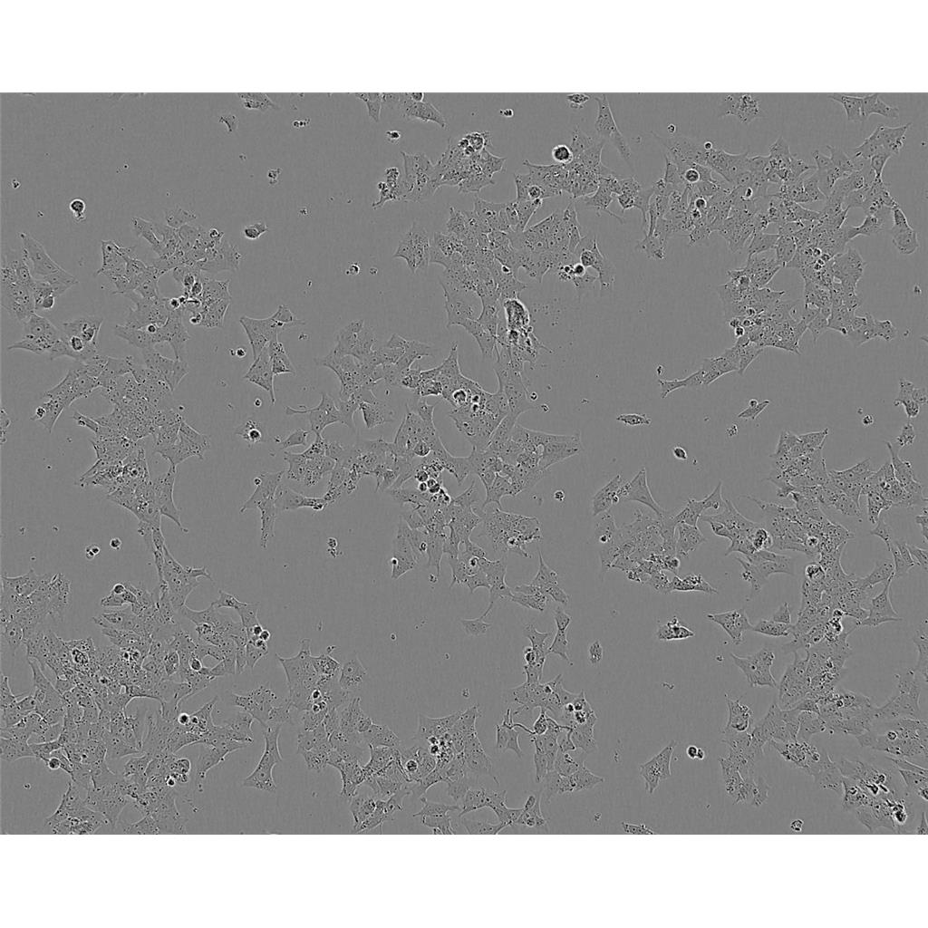 NCIH1437 Cells#人非小细胞肺癌细胞系复苏中心|完全培养基|STR图谱