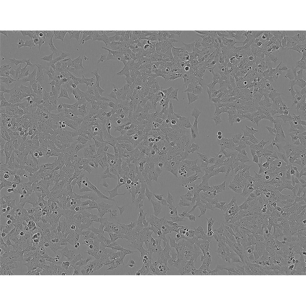 OPM2人多发性骨髓瘤细胞新批次|培养基|送STR图谱