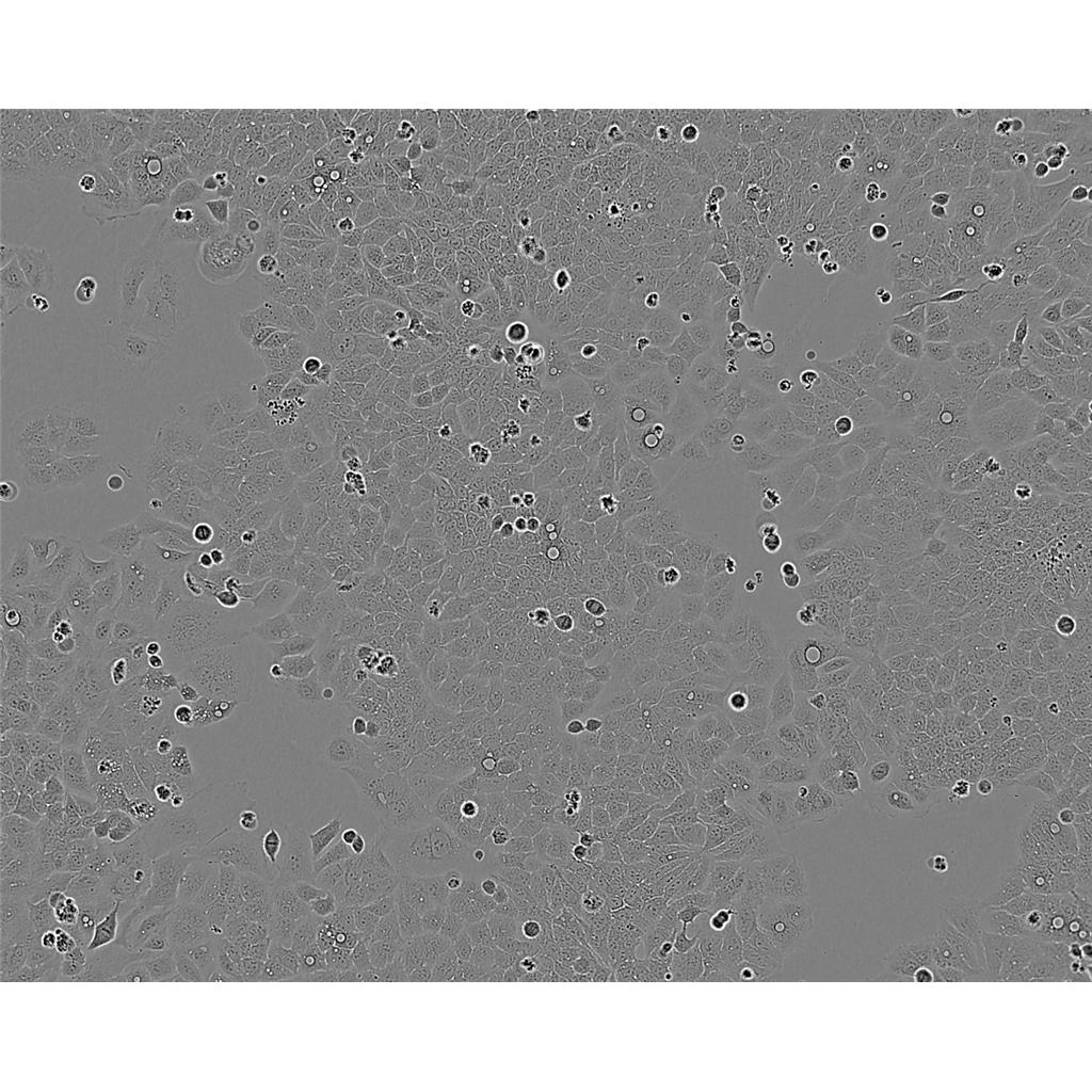 H508 Cells#人结肠直肠腺癌细胞系复苏中心|完全培养基|STR图谱