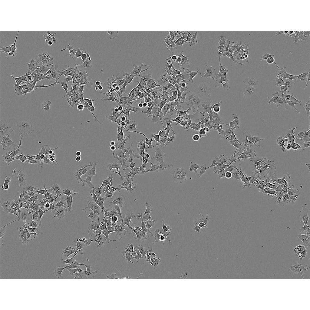 H-1650 Cells#人非小细胞肺癌细胞系复苏中心|完全培养基|STR图谱