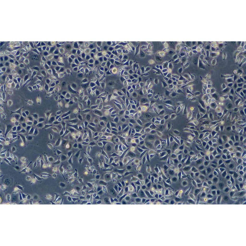 HCT-8 Cells#人结直肠腺癌细胞系复苏中心|完全培养基|STR图谱