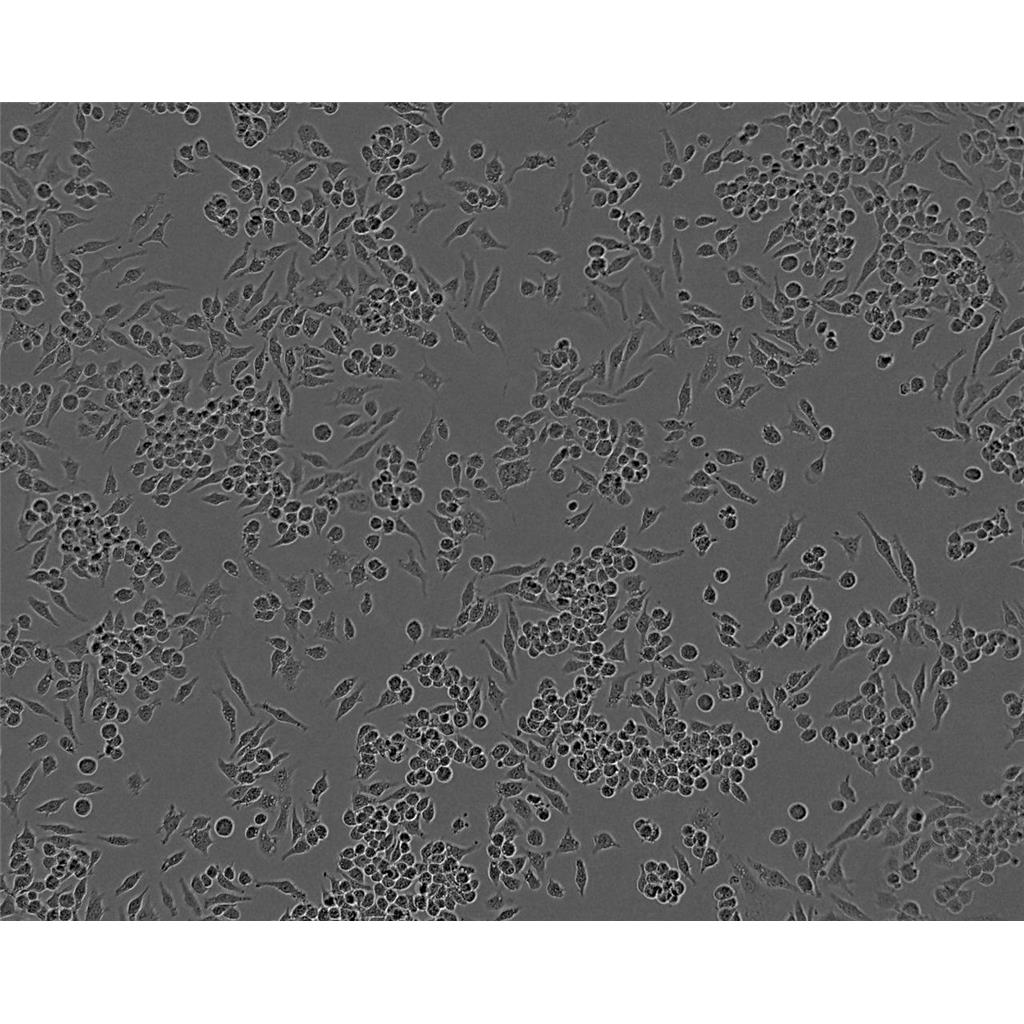 U251人胶质瘤细胞实验室|已有STR图谱