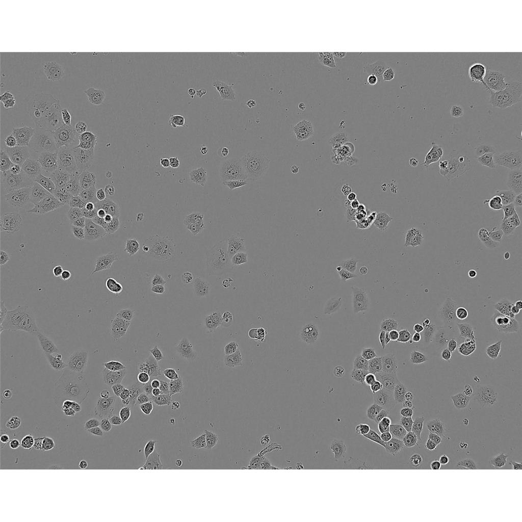 UACC 812 Cells人乳腺导管瘤细胞系(提供STR图谱)