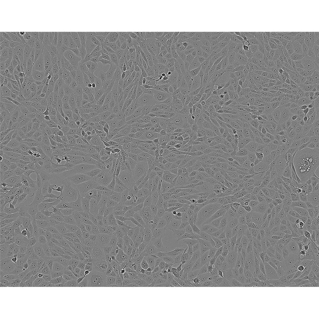 B95.8 Cells#绒猴EBV转化的白细胞系复苏中心|完全培养基|STR图谱