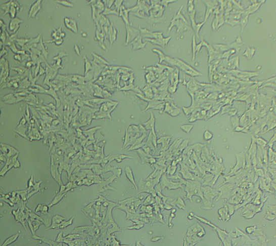 A875 Cells#人黑色素瘤细胞系复苏中心|完全培养基|STR图谱