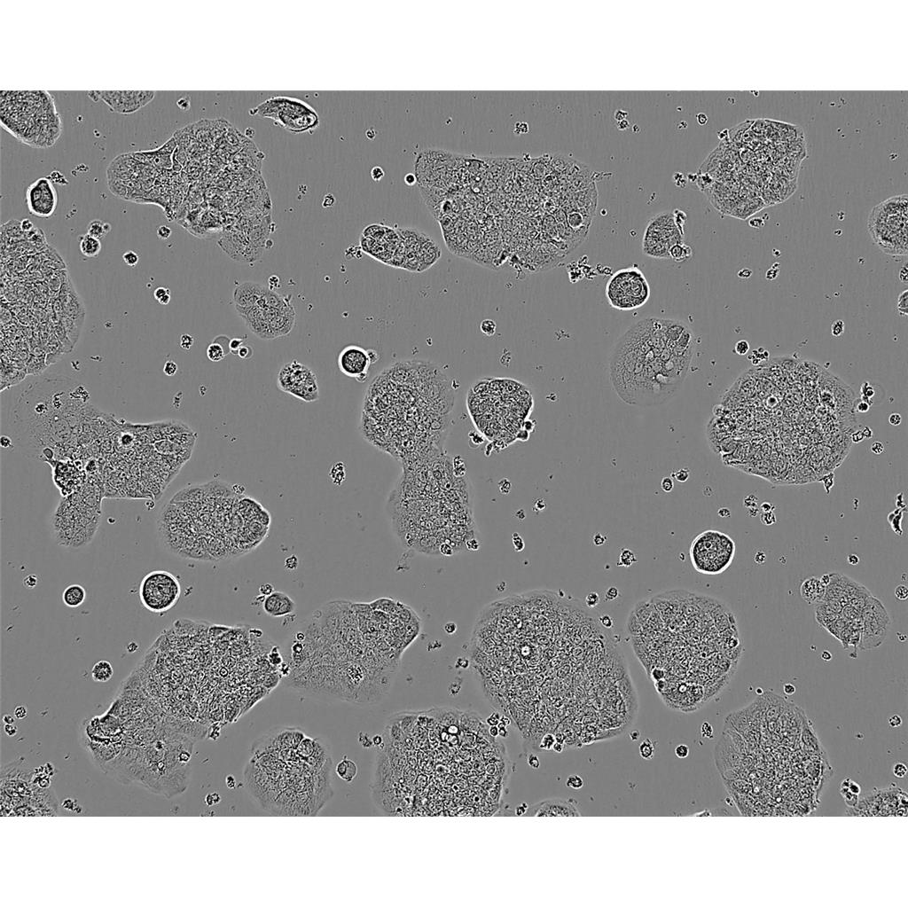 NCI.H460 Cells#人大细胞肺癌细胞系复苏中心|完全培养基|STR图谱