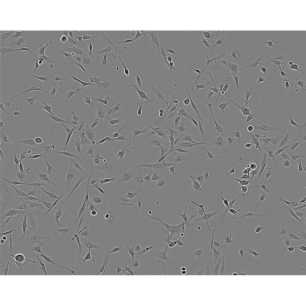 HCT 8 Cells#人结直肠腺癌细胞系复苏中心|完全培养基|STR图谱