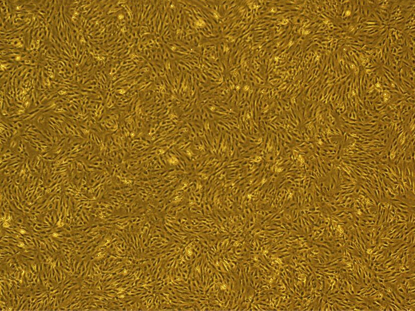 HT-1080 Cells#人纤维肉瘤细胞系复苏中心|完全培养基|STR图谱