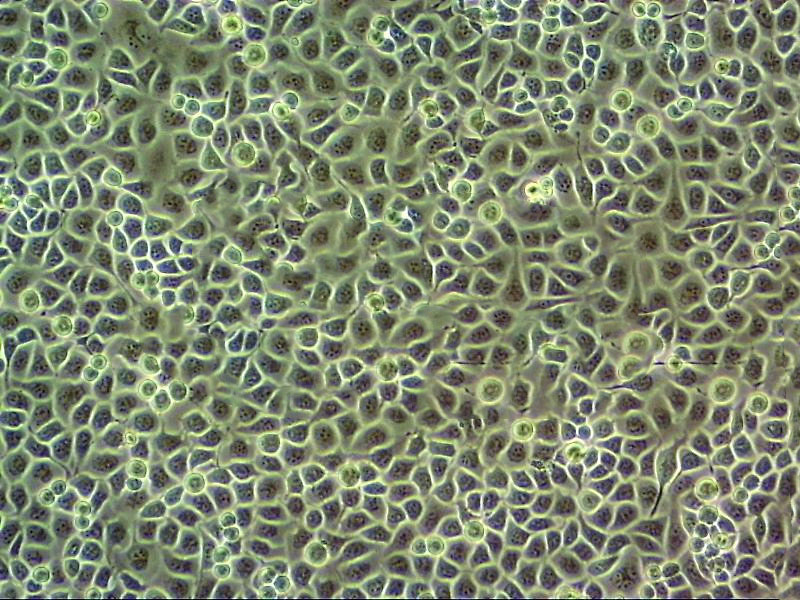 BEAS-2B Cells#人支气管上皮细胞系复苏中心|完全培养基|STR图谱