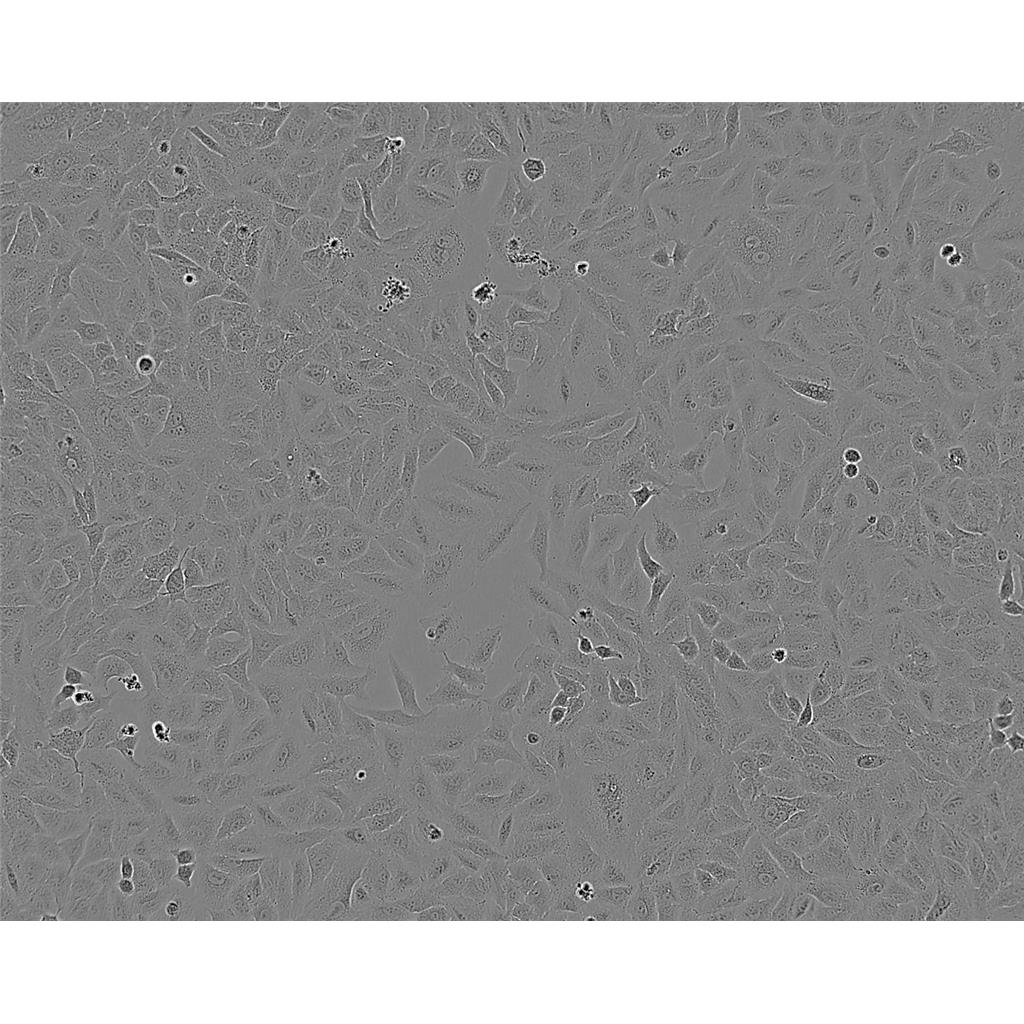 SKBr3 Cells#人乳腺腺癌细胞系源头种子库|培养基|STR图谱