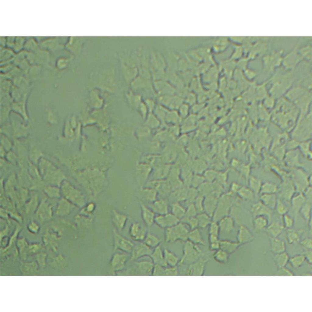 CL-11人结肠癌细胞实验室|已有STR图谱