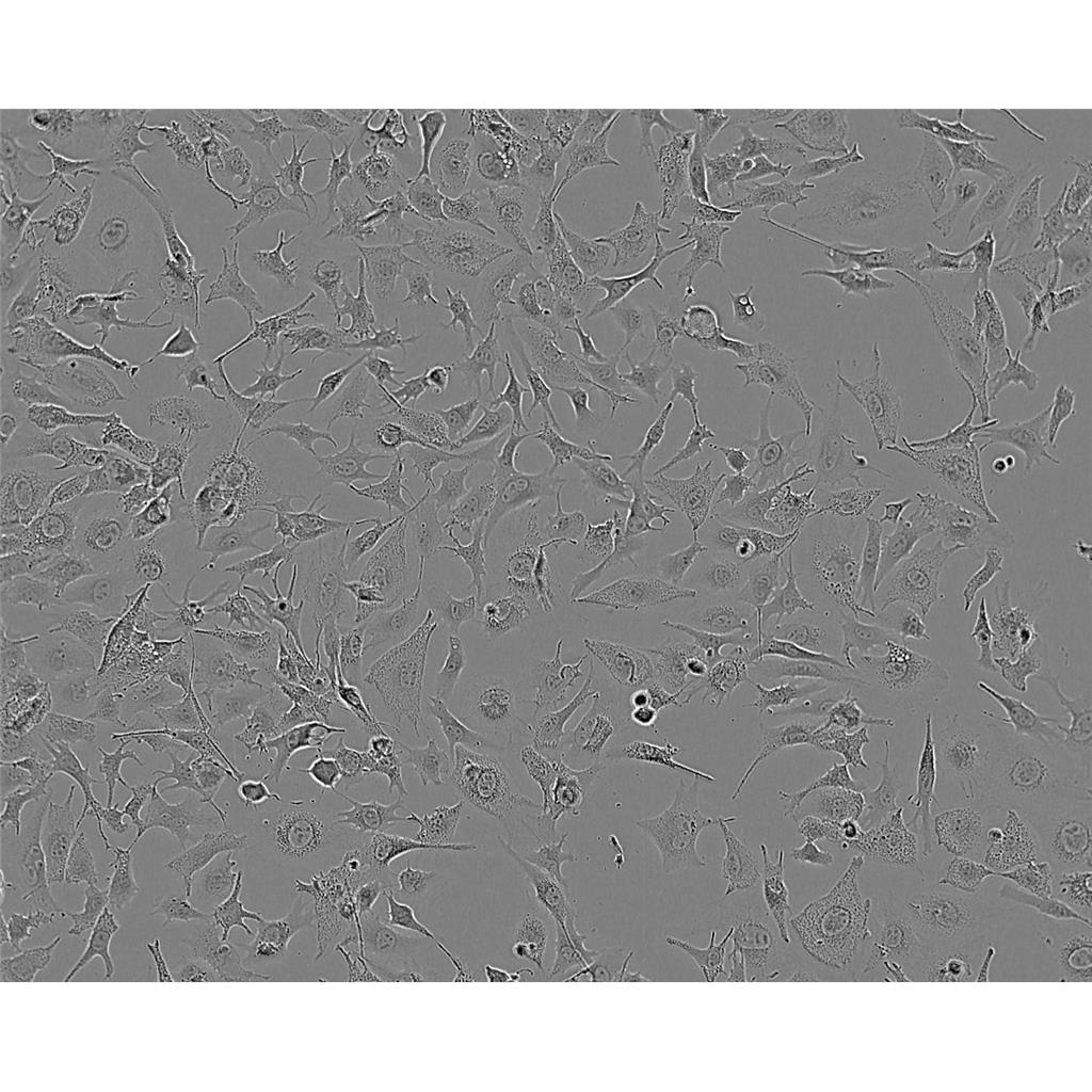 Saos2 Cells#人成骨肉瘤细胞系源头种子库|培养基|STR图谱