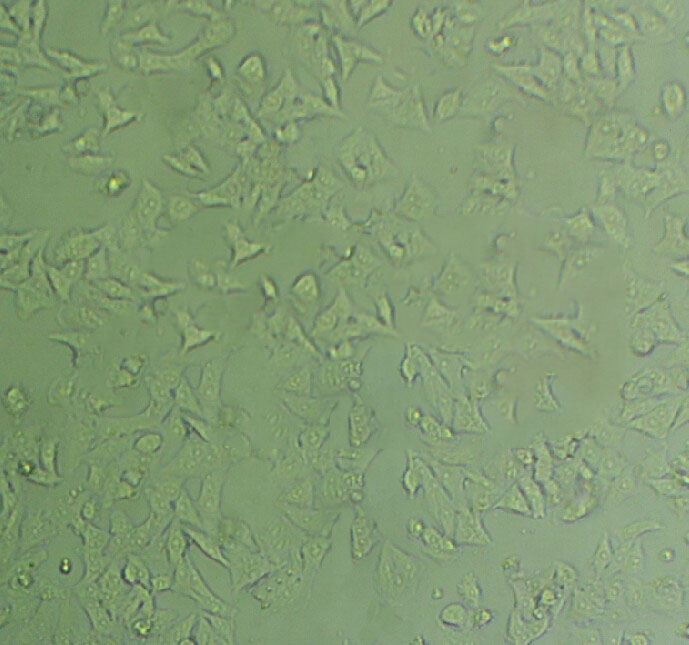 EC109 Cells#人食管癌细胞系源头种子库|培养基|STR图谱