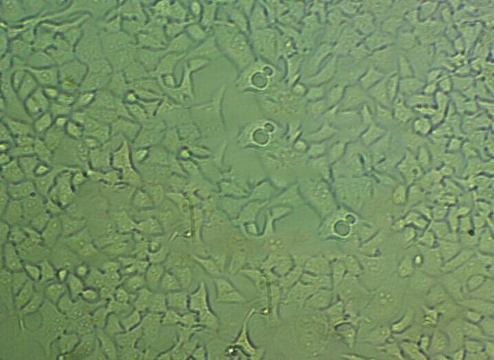 NCI-N87人胃癌细胞代次低|培养基|送STR图谱