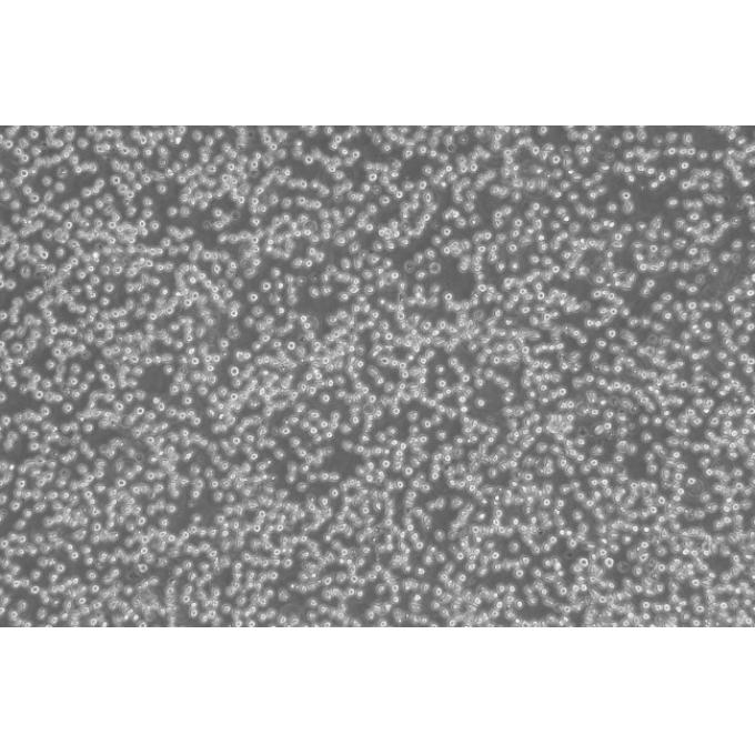 SUDHL-4 Cells人弥漫性组织淋巴瘤可传代细胞系(送STR鉴定图谱)