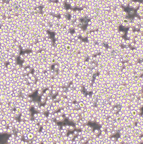 SUDHL4 Cells人弥漫性组织淋巴瘤可传代细胞系(送STR鉴定图谱)