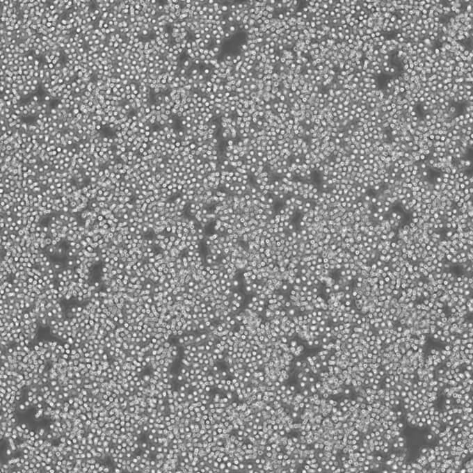 OCI-Ly3 Cells人弥漫大B细胞淋巴瘤可传代细胞系(送STR鉴定图谱)