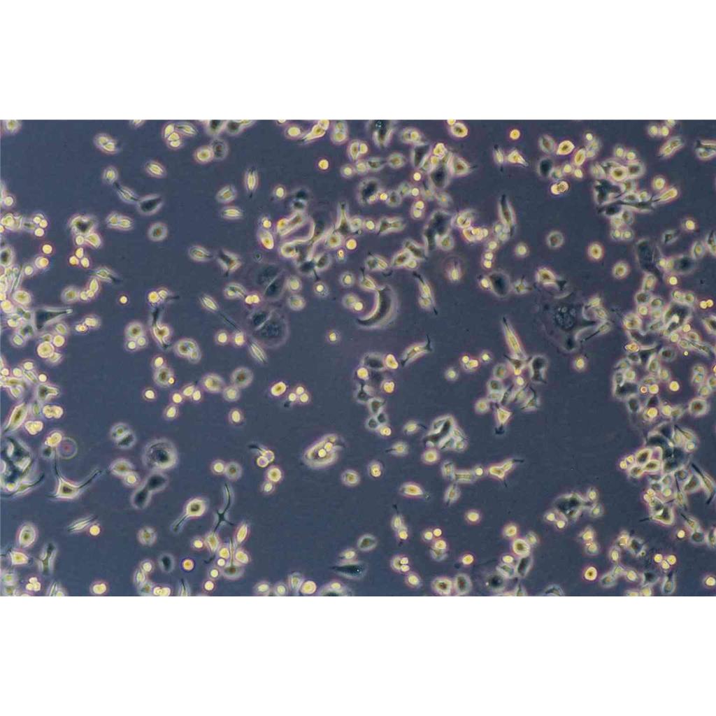 SUPB15 Cells#人Ph+急淋白血病细胞系源头种子库|培养基|STR图谱