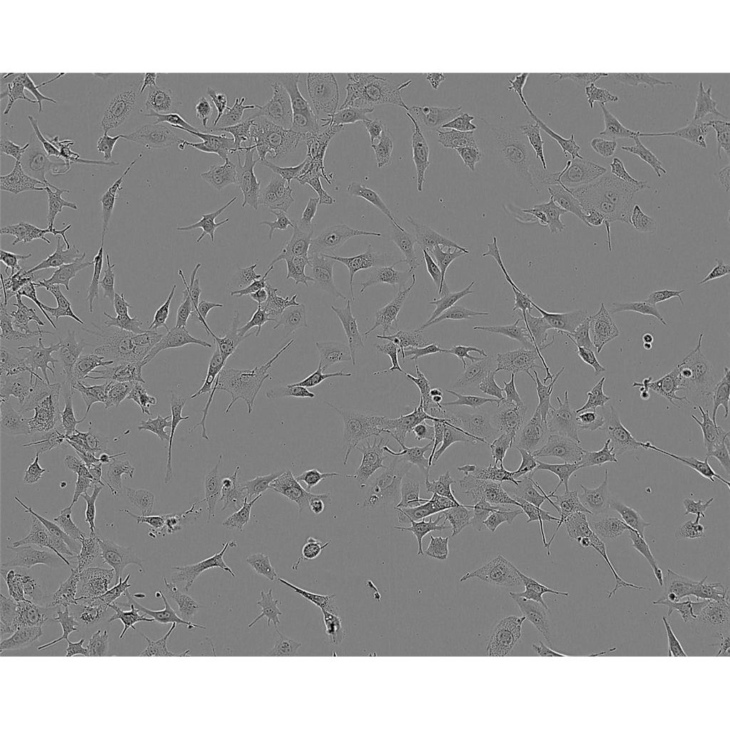 HuT 102 Cells#人T淋巴瘤细胞系保种中心(通过STR鉴定)