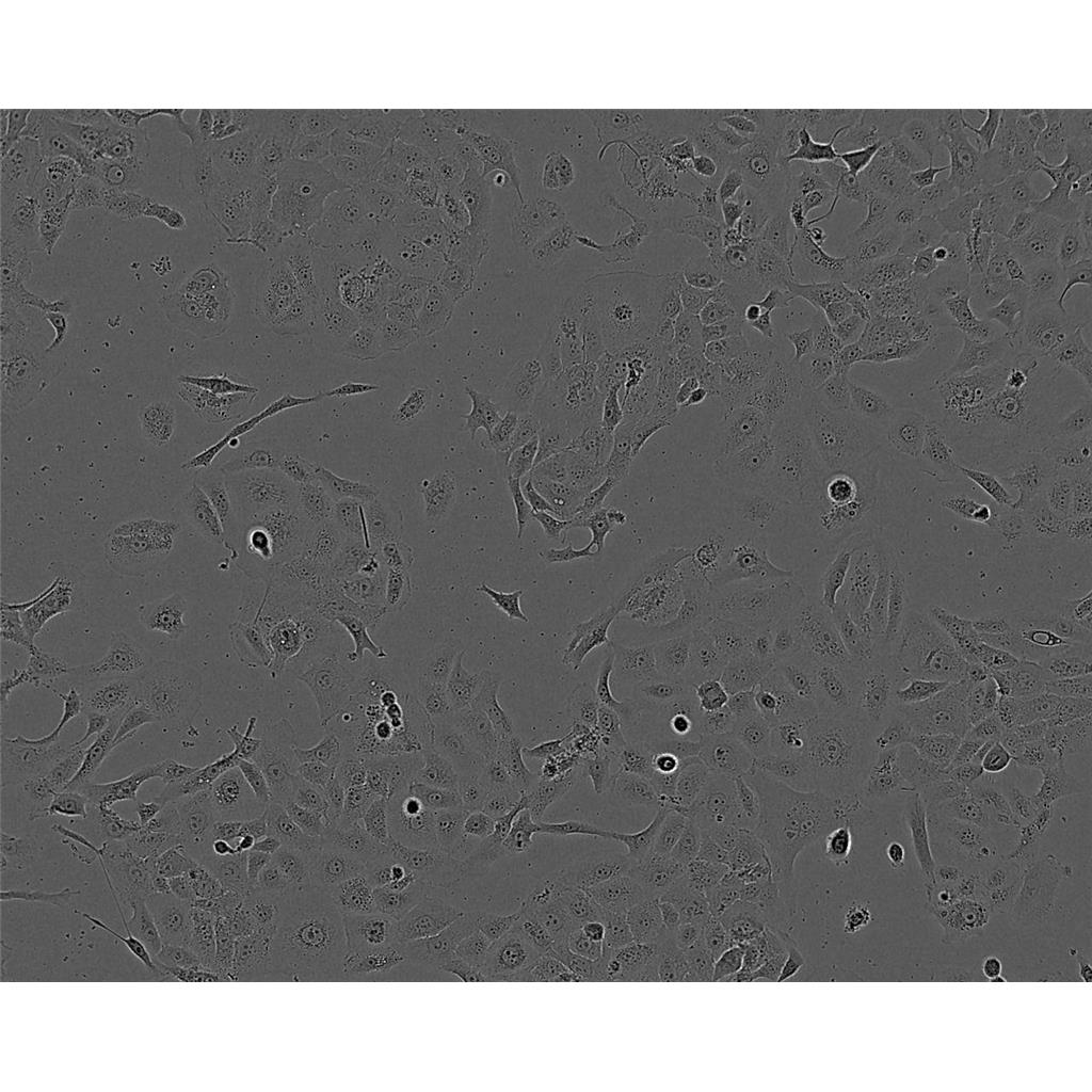 MDA-MB-157人乳腺癌细胞实验室|已有STR图谱