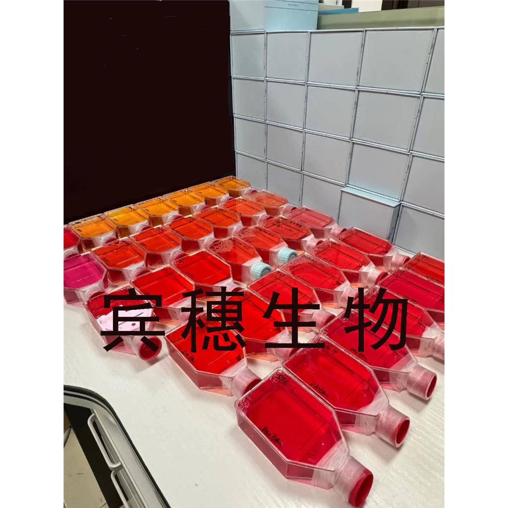 Hepatoma-22 Cells#小鼠肝癌细胞系保种中心(通过STR鉴定)