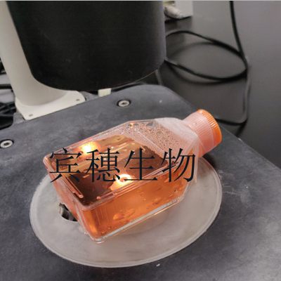 HT(H9)人T淋巴瘤细胞复苏中心|完全培养基|鉴定图谱