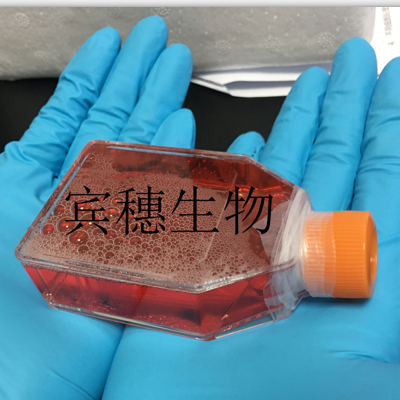 NCI-BL2009 Cells人淋巴母悬浮细胞系<EBV转化>(赠送STR基因图谱)