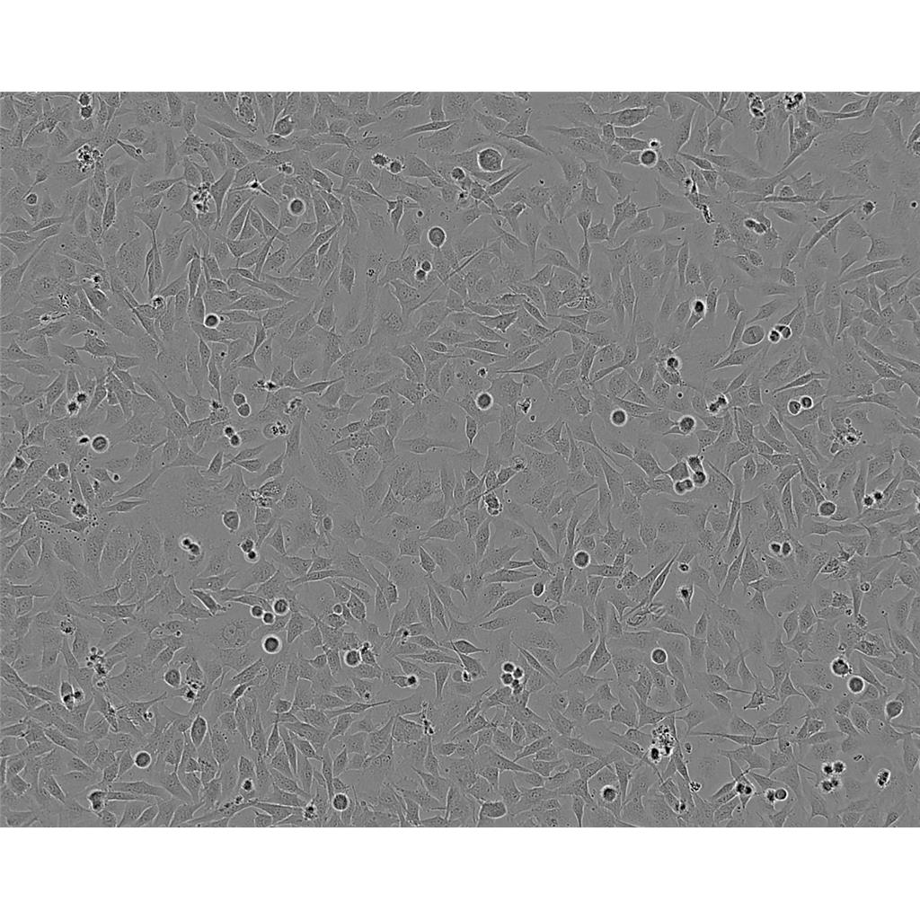 NCI-H2122人非小细胞肺癌细胞实验室|已有STR图谱