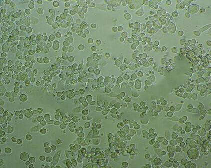 EB-3 Cells#人Burkitt's淋巴瘤细胞系种子库|STR图谱