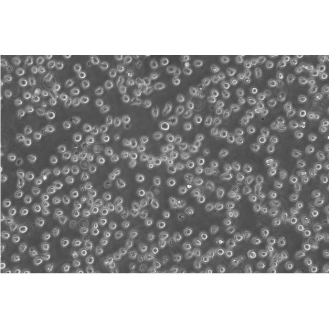 dami Cells#人巨核细胞白血病细胞系种子库|STR图谱