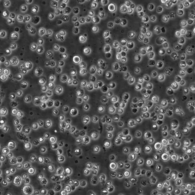 NCI-H2227人小细胞肺癌细胞传代性好|带STR图谱