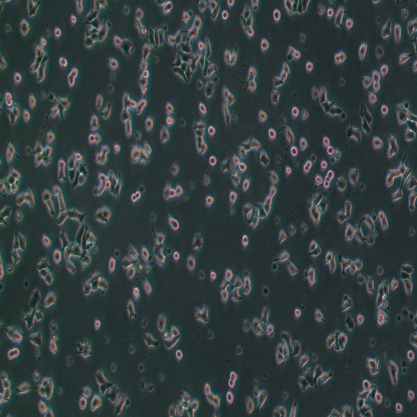 NIH:OVCAR-3/GFP细胞