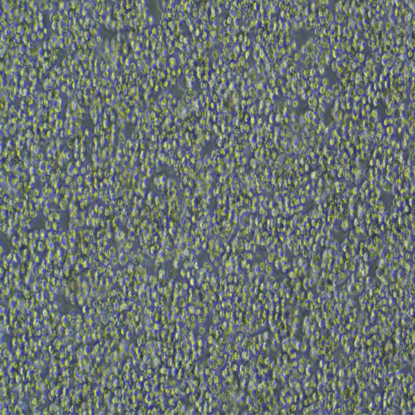 UWB1.289+BRCA1细胞