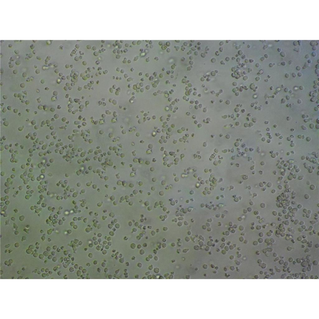 QBC939 cells人胆管癌细胞系