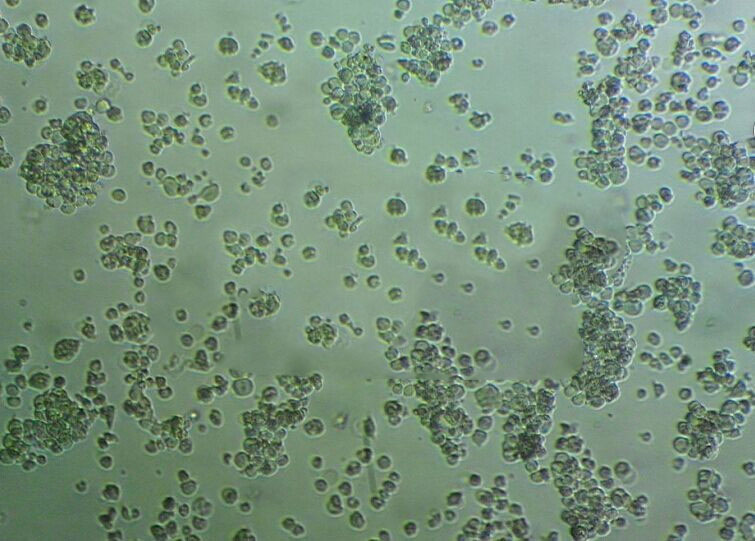 COV362 cells人卵巢癌细胞系
