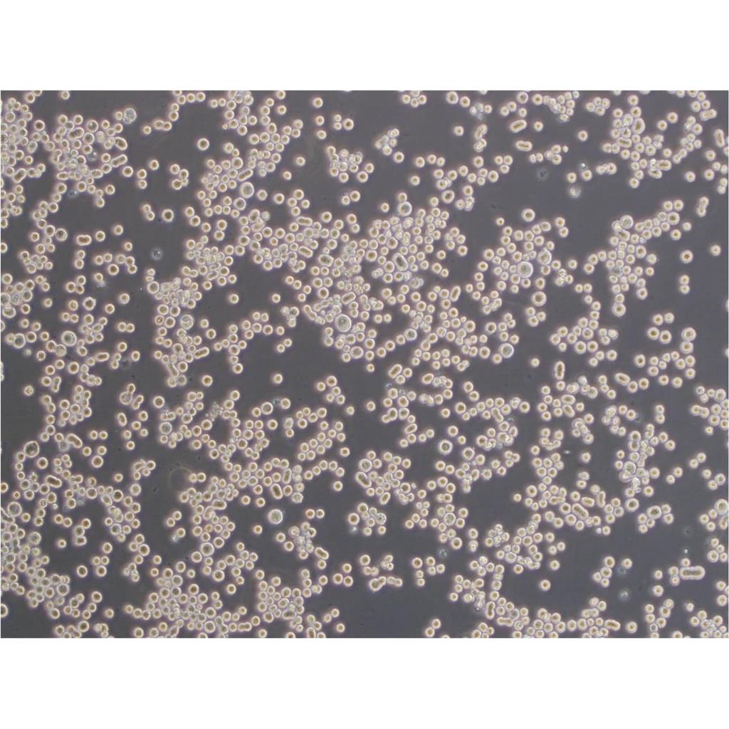 NCI-H295R Cells#人肾上腺皮质腺癌细胞系源头种子库|培养基|STR图谱