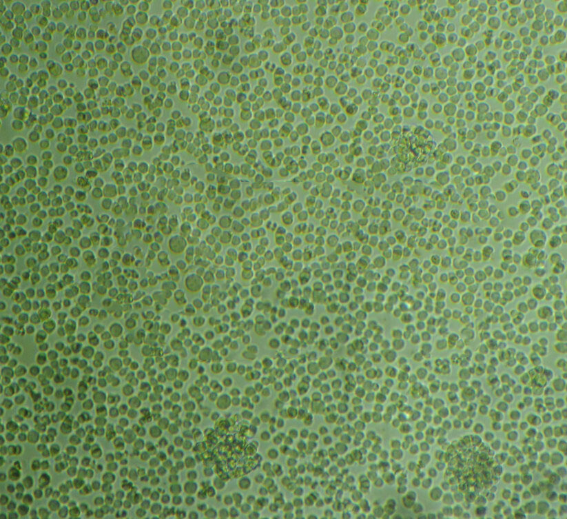 MRC-5 Cells#人胚肺细胞系复苏中心|完全培养基|STR图谱