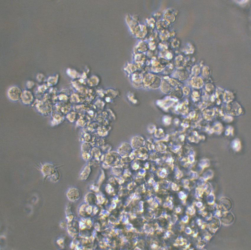 MDA-MB-361 Cells#人乳腺癌细胞系种子库|完全培养基|STR图谱
