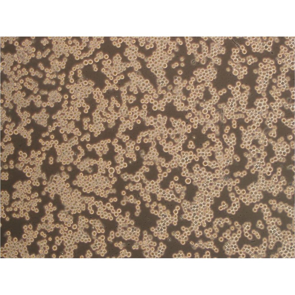 MS751 Cells#人子宫颈表皮癌细胞系种子库|完全培养基|STR图谱