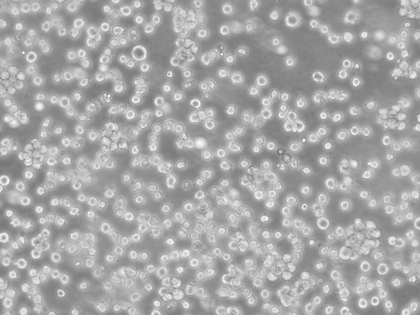 HFF-1 Cells人包皮成纤维细胞批次新|送STR图谱