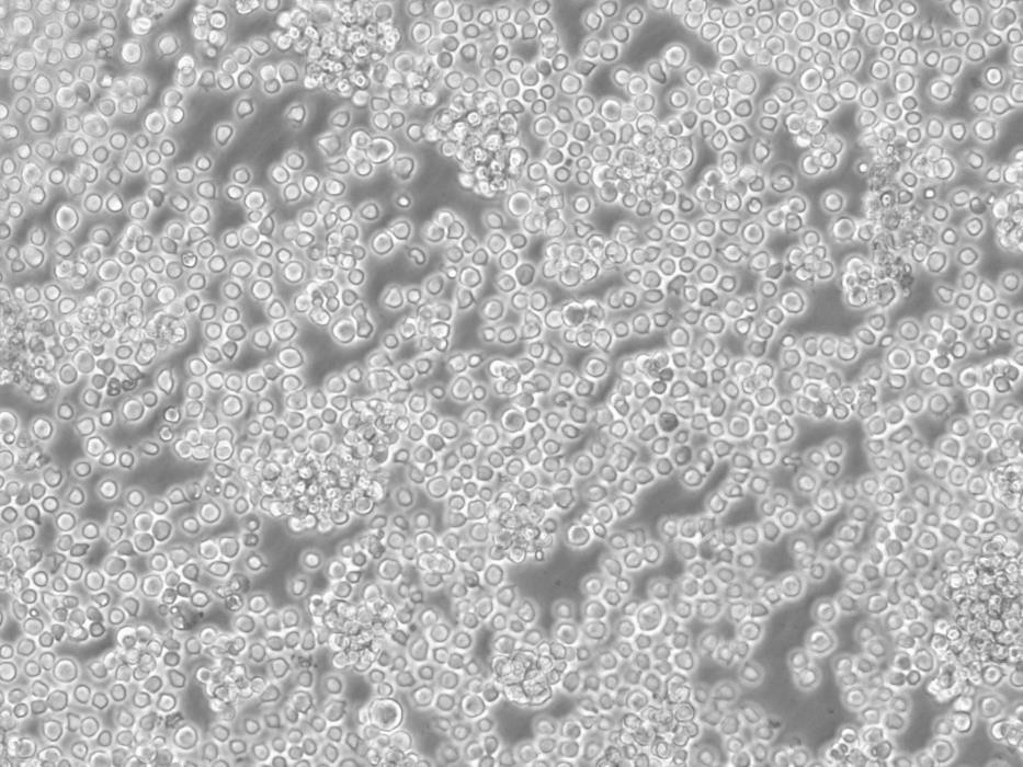 HCT-8[HRT-18] Cells#人回盲肠癌细胞系实验室|完全培养基|鉴定图谱