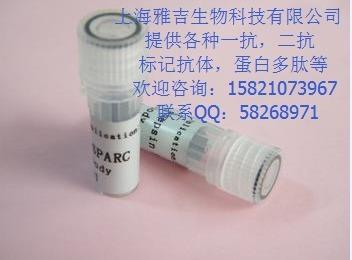 抗体11.jpg 抗体11.jpg