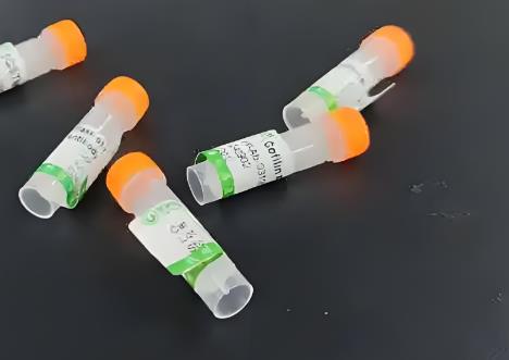 胶质纤维酸性蛋白抗体（GFAP Antibody）-自主研发
