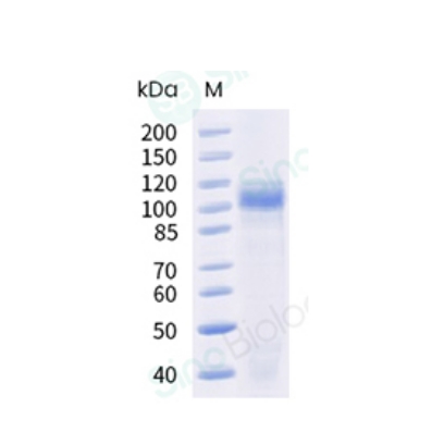 Recombinant Cynomolgus Cadherin-17 Protein (His Tag), HPLC-verified (义翘神州 90994-C08H)