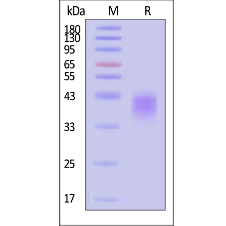 Human Fc gamma RIIIB / CD16b (NA1) Protein, His Tag (百普赛斯 CDB-H5227)
